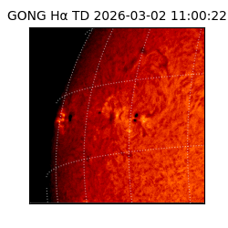 gong - 2026-03-02T11:00:22