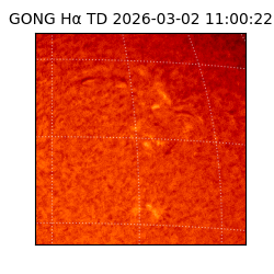 gong - 2026-03-02T11:00:22