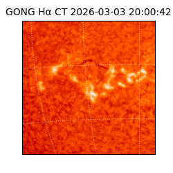 gong - 2026-03-03T20:00:42