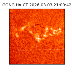 gong - 2026-03-03T21:00:42