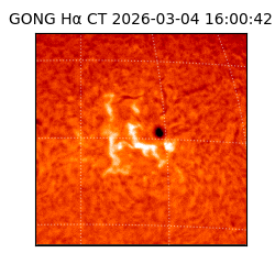 gong - 2026-03-04T16:00:42