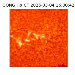 gong - 2026-03-04T16:00:42