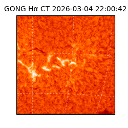 gong - 2026-03-04T22:00:42