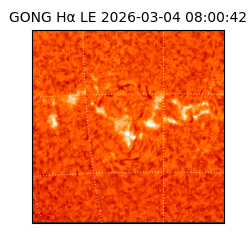 gong - 2026-03-04T08:00:42