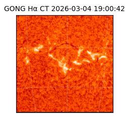 gong - 2026-03-04T19:00:42