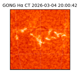 gong - 2026-03-04T20:00:42