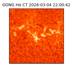 gong - 2026-03-04T22:00:42