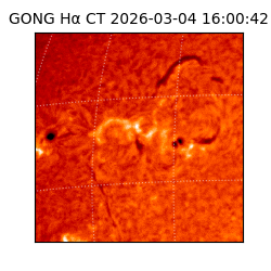 gong - 2026-03-04T16:00:42