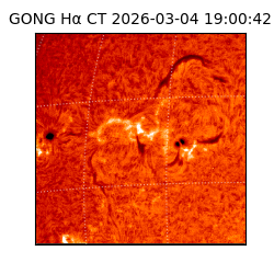 gong - 2026-03-04T19:00:42