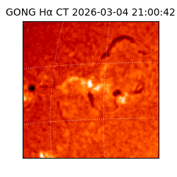 gong - 2026-03-04T21:00:42