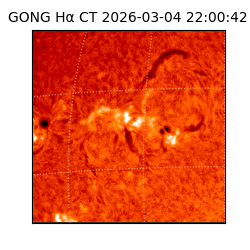 gong - 2026-03-04T22:00:42