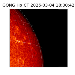 gong - 2026-03-04T18:00:42