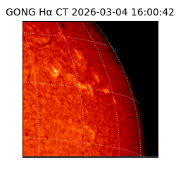 gong - 2026-03-04T16:00:42