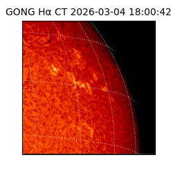 gong - 2026-03-04T18:00:42