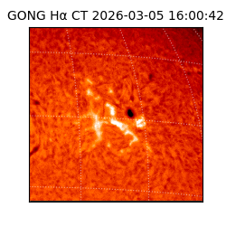 gong - 2026-03-05T16:00:42