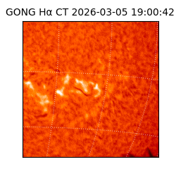 gong - 2026-03-05T19:00:42