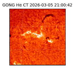 gong - 2026-03-05T21:00:42