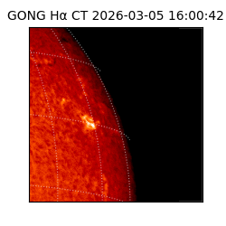 gong - 2026-03-05T16:00:42