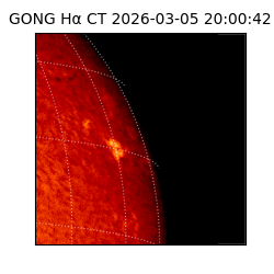 gong - 2026-03-05T20:00:42