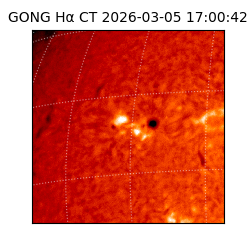 gong - 2026-03-05T17:00:42