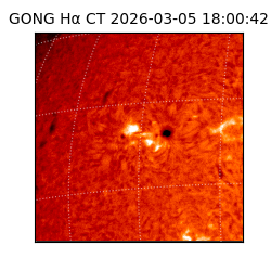 gong - 2026-03-05T18:00:42