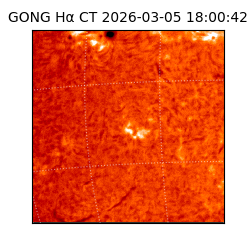 gong - 2026-03-05T18:00:42