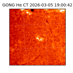 gong - 2026-03-05T19:00:42