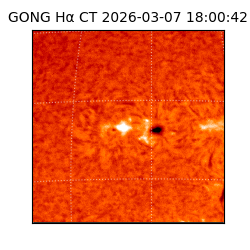 gong - 2026-03-07T18:00:42