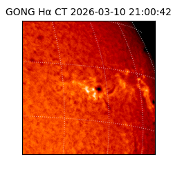 gong - 2026-03-10T21:00:42