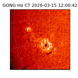 gong - 2026-03-15T12:00:42