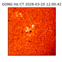 gong - 2026-03-20T12:00:42