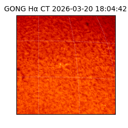 gong - 2026-03-20T18:04:42