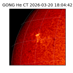 gong - 2026-03-20T18:04:42