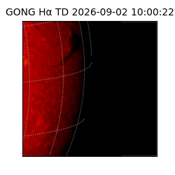 gong - 2026-09-02T10:00:22