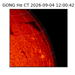 gong - 2026-09-04T12:00:42
