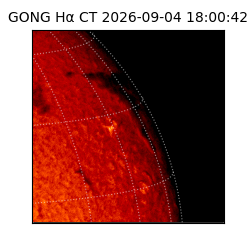 gong - 2026-09-04T18:00:42