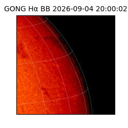 gong - 2026-09-04T20:00:02