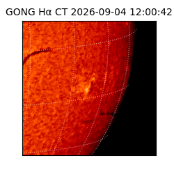 gong - 2026-09-04T12:00:42