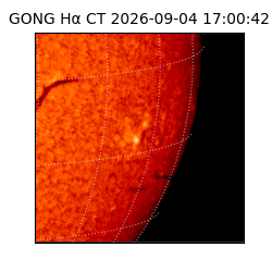 gong - 2026-09-04T17:00:42