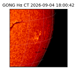 gong - 2026-09-04T18:00:42