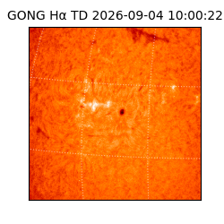 gong - 2026-09-04T10:00:22