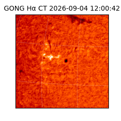 gong - 2026-09-04T12:00:42