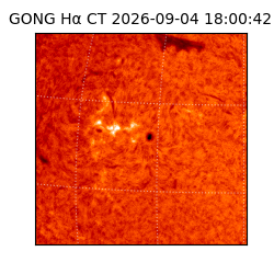 gong - 2026-09-04T18:00:42