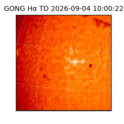 gong - 2026-09-04T10:00:22