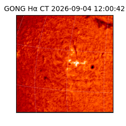 gong - 2026-09-04T12:00:42
