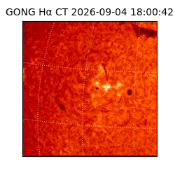 gong - 2026-09-04T18:00:42