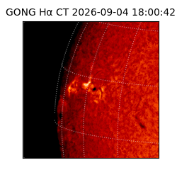 gong - 2026-09-04T18:00:42