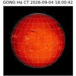 gong - 2026-09-04T18:00:42