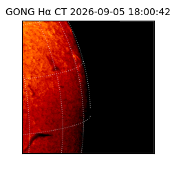 gong - 2026-09-05T18:00:42