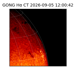 gong - 2026-09-05T12:00:42